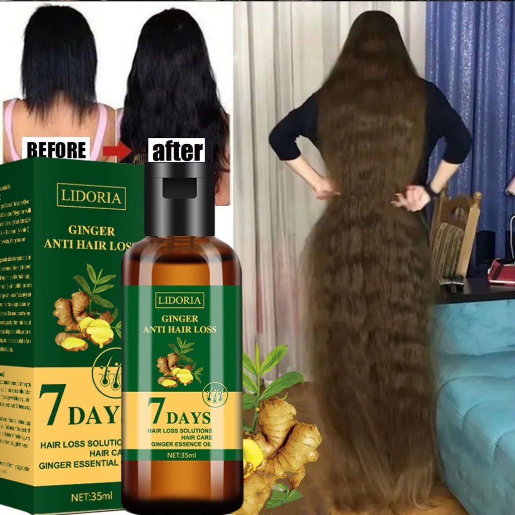 Aichun Beauty 7 Days King of Ginger Hair Growth Oil – Rapid Regrowth &amp; Fuller Hair