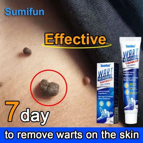 Warts Remover Ointment – Fast, Gentle &amp; Natural Skin Growth Removal
