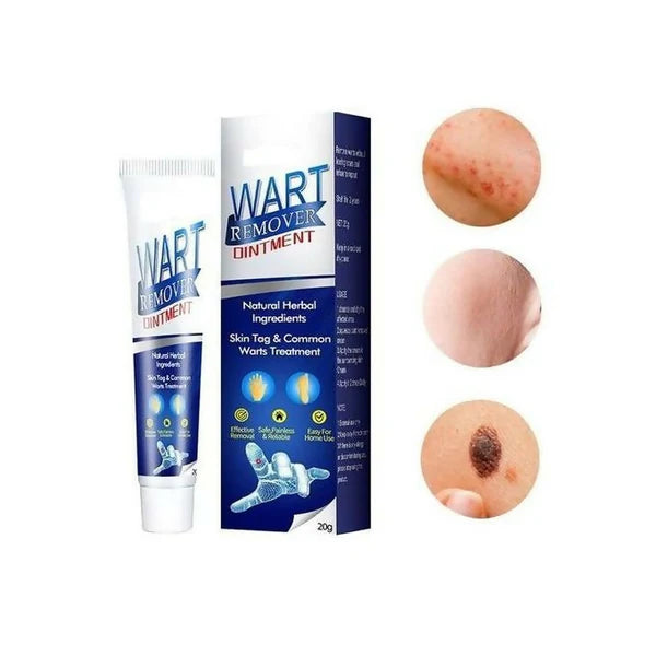 Warts Remover Ointment – Fast, Gentle &amp; Natural Skin Growth Removal